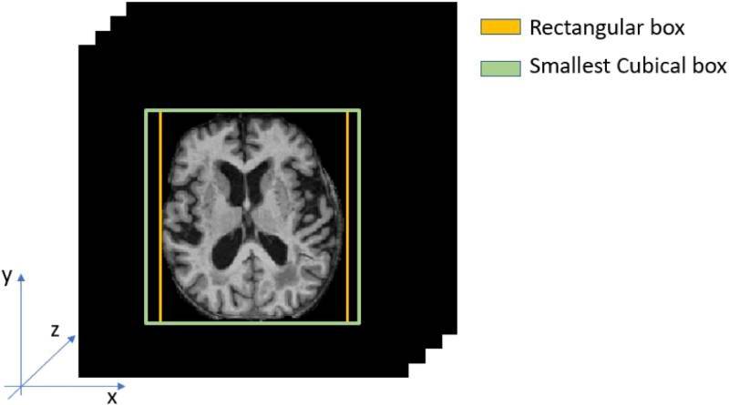 Inteligencia artificial para mejorar la detección precoz de la demencia