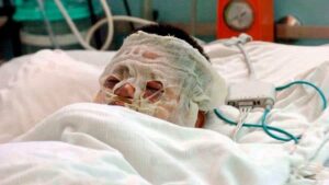 Mujer rocía con combustible a su pareja y le prende fuego