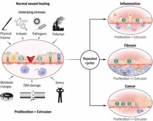 Un estudio sugiere que la acumulación de heridas mal sanadas podría ser una causa de cáncer, fibrosis o inflamación.