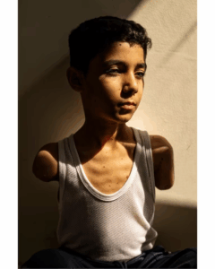 World Press Photo: la imagen de un niño mutilado en Gaza ganó el premio a la mejor foto del año