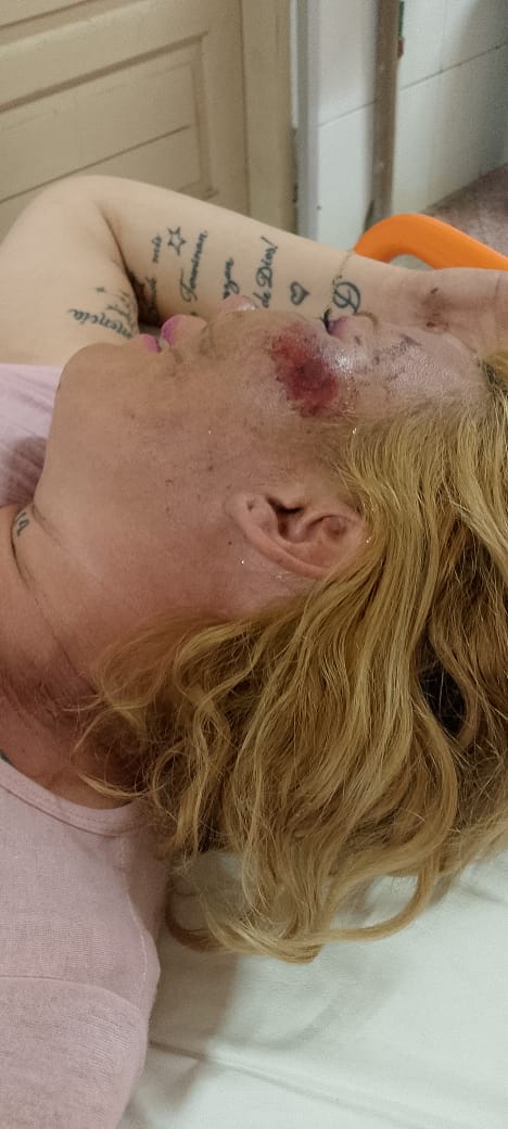 Detienen a hombre por brutal agresión a su expareja hace seis meses