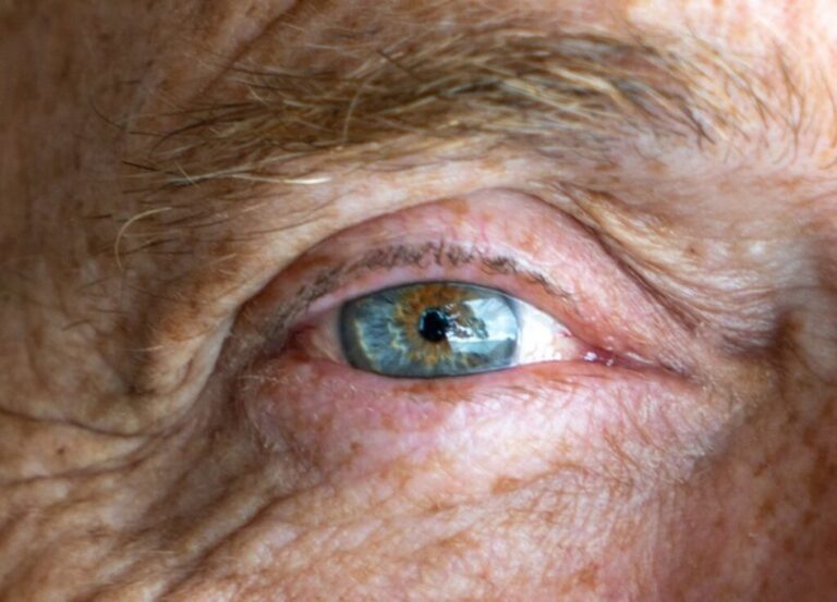 El 80% de los españoles enfrenta problemas de visión