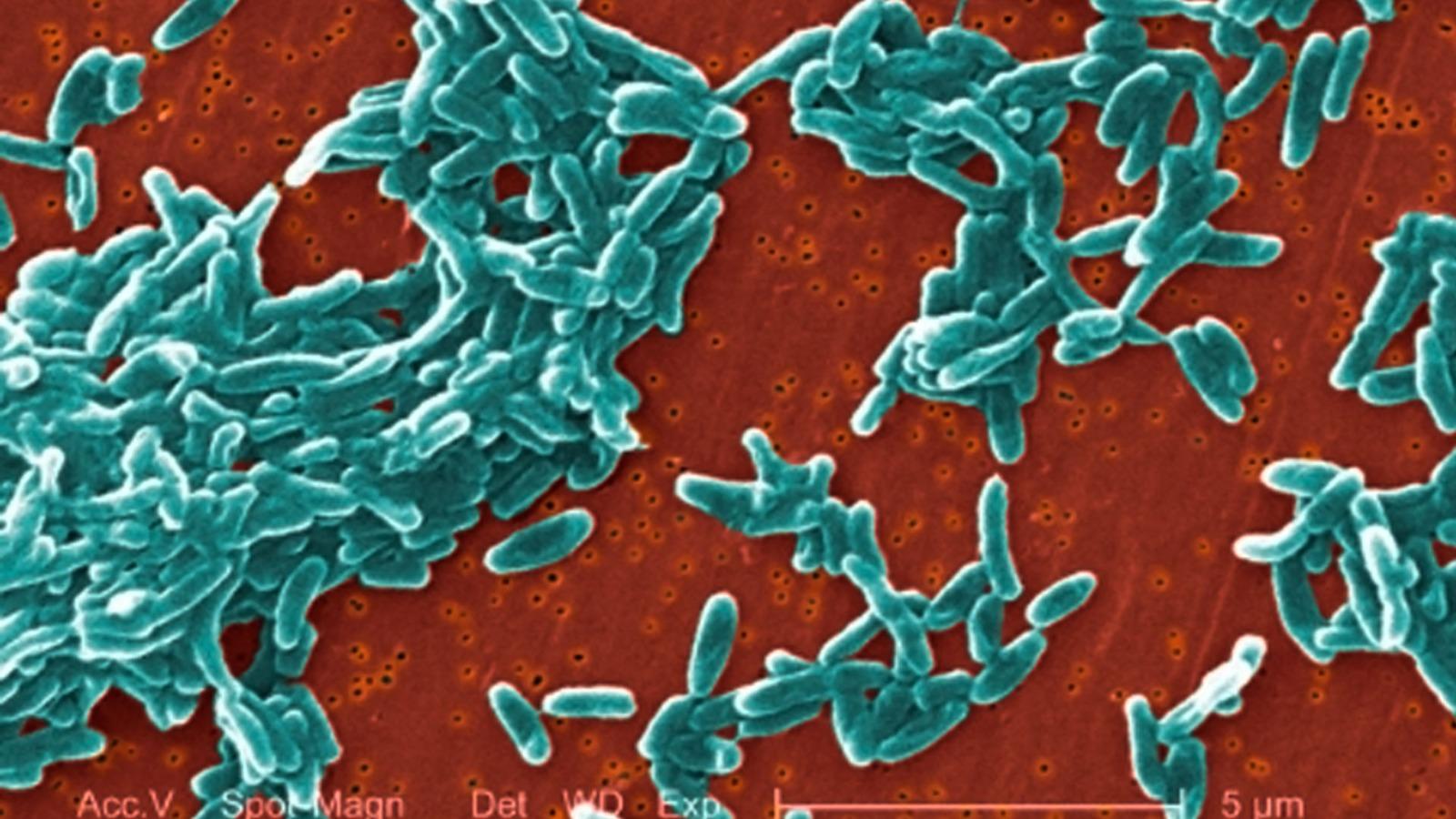CCSS reafirma que no se registran nuevos casos de Ralstonia en hospitales CCSS reafirma que no se registran nuevos casos de Ralstonia en hospitales