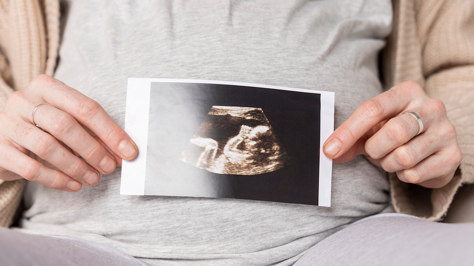 La ecografía de las 20 semanas