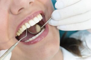 Entre el 30% y el 50% de los casos de hipertensión arterial y diabetes podrían identificarse en consultas dentales.