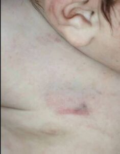 Internado de urgencias: Bebecito habría sido golpeado por su propio padre