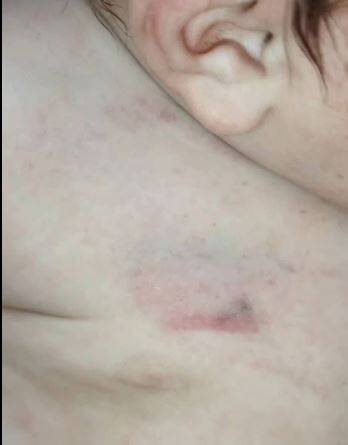 Internado de urgencias: Bebecito habría sido golpeado por su propio padre