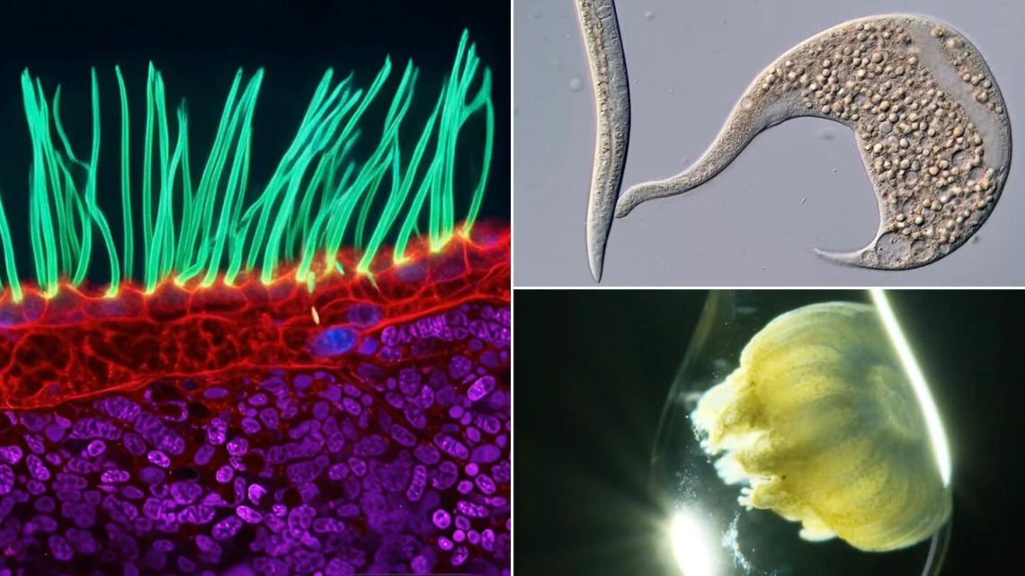 Dr. Ning Xu gana Nikon Small World 2026 con imágenes de cilias en PCD, destacando la belleza microscópica en la ciencia Dr. Ning Xu gana Nikon Small World 2026 con imágenes de cilias en PCD, destacando la belleza microscópica en la ciencia